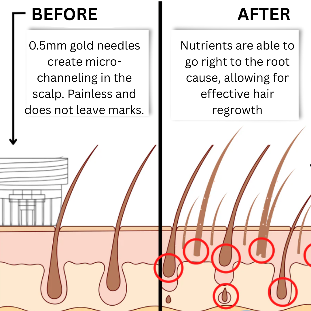FollicureLabs™ | Hair Regrowth System