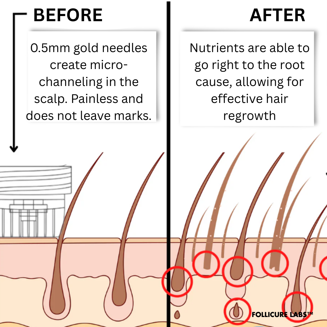 FollicureLabs™ | Hair Regrowth System